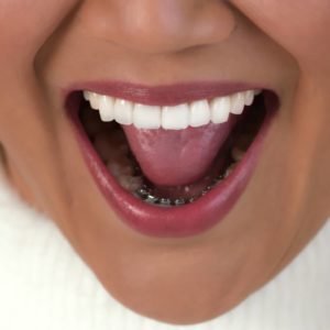 orthodontist brooklyn ny