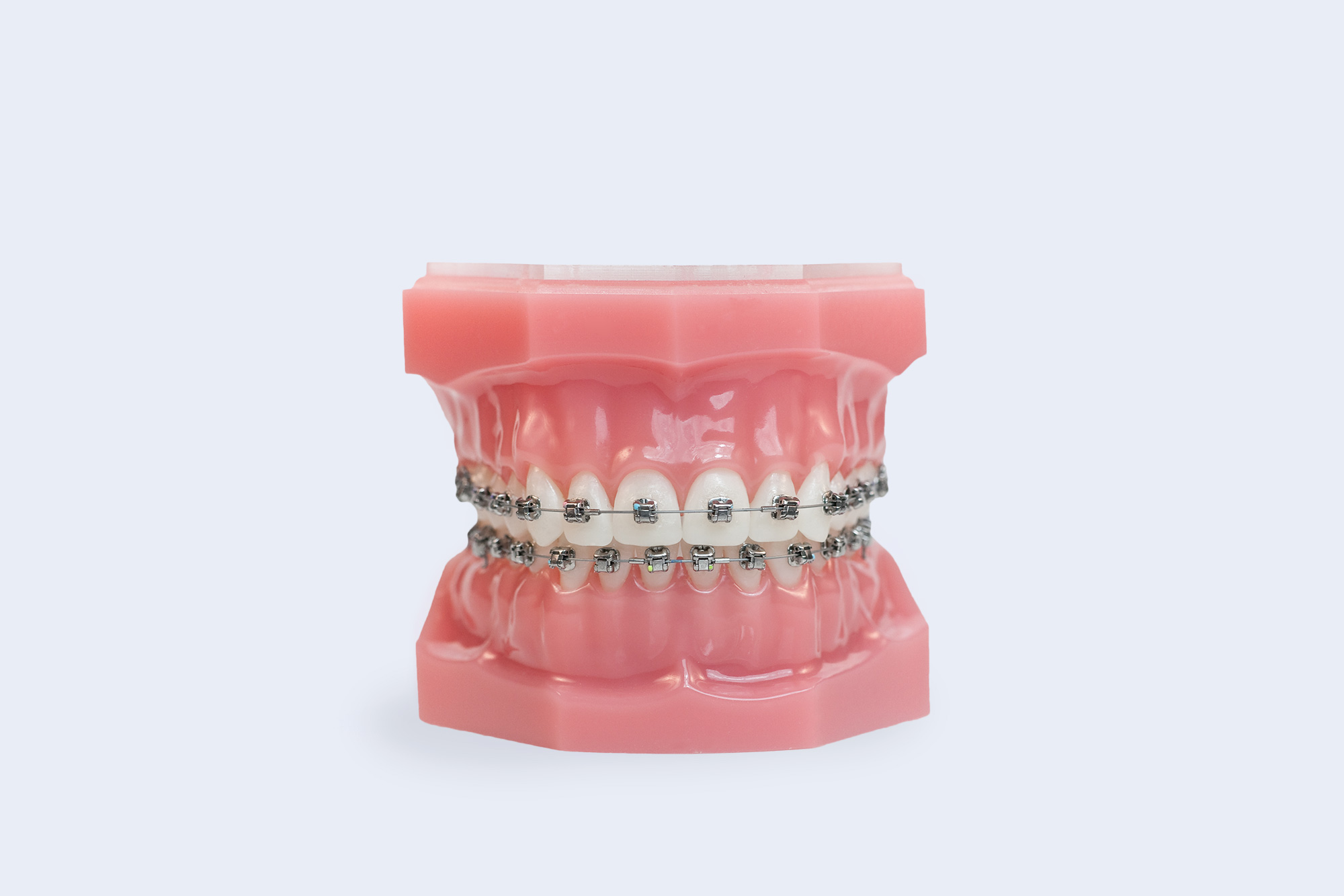 Orthodontist Brooklyn NY