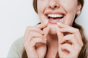 Why Clear Aligners Are Perfect for Teens